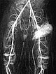 MR angiography after contrast injection