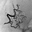 X-ray: cast specimen of the entire nidus