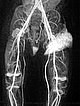 MR angiography after contrast injection