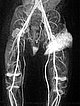 MR angiography after contrast injection