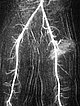 MR angiography after contrast injection