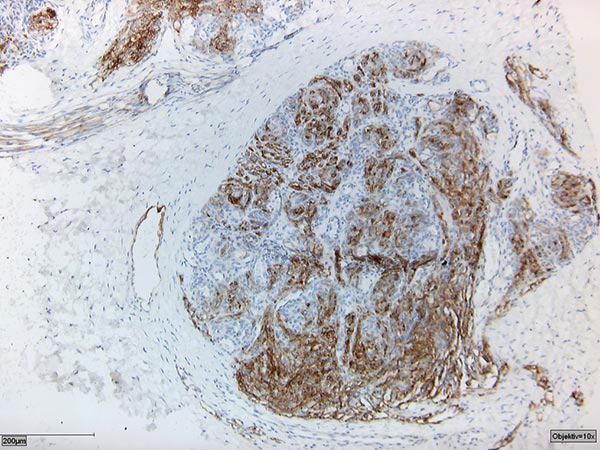 Histopathologic specimen