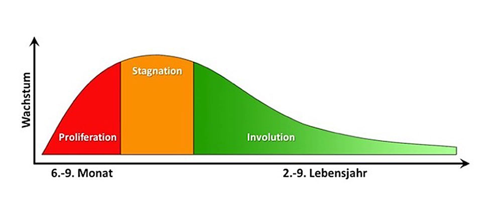 Typical growth phases of an infantile hemangioma