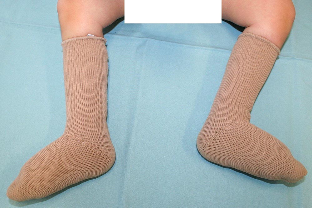 Lower leg compression stockings
