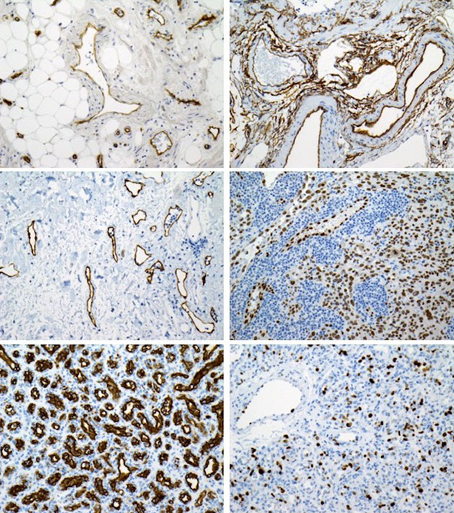 Sample images of some important immunohistochemical stains
