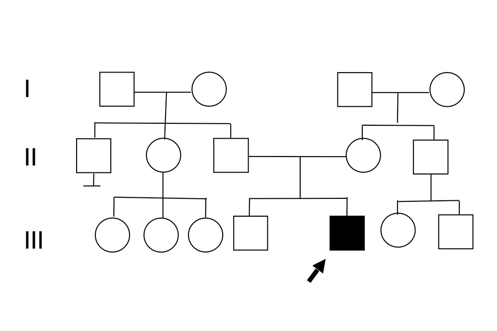 Autosomal dominant inheritance