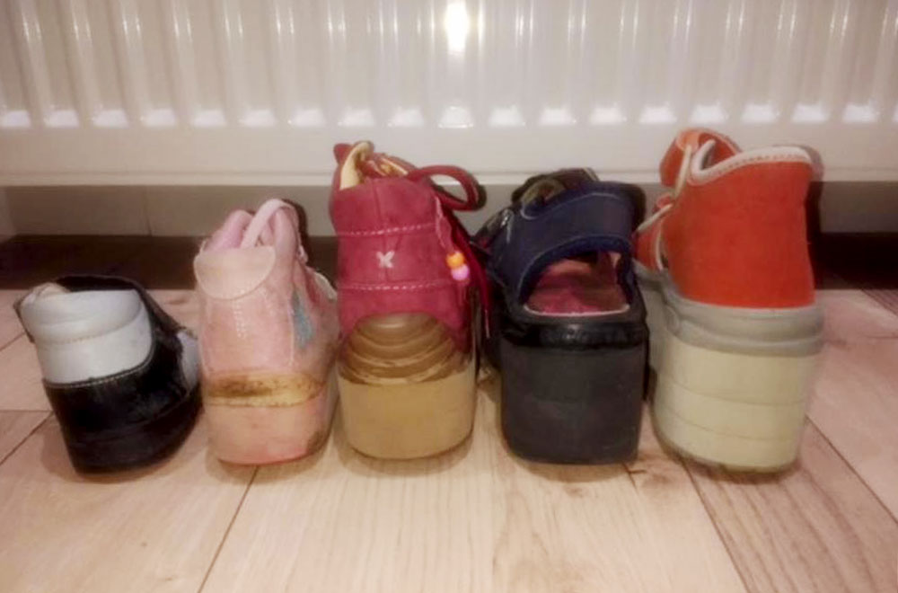 Shoes of a young patient with different leg lengths